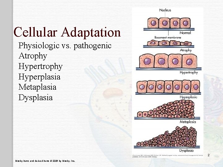 Cellular Adaptation Physiologic vs. pathogenic Atrophy Hyperplasia Metaplasia Dysplasia 2 Mosby items and derived