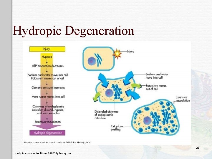 Hydropic Degeneration 26 Mosby items and derived items © 2006 by Mosby, Inc. 