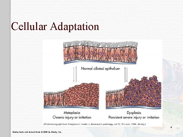 Cellular Adaptation 4 Mosby items and derived items © 2006 by Mosby, Inc. Cellular Adaptation 4 Mosby items and derived items © 2006 by Mosby, Inc.