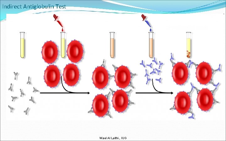Indirect Antiglobulin Test Wael Al Laithi. , IUG 