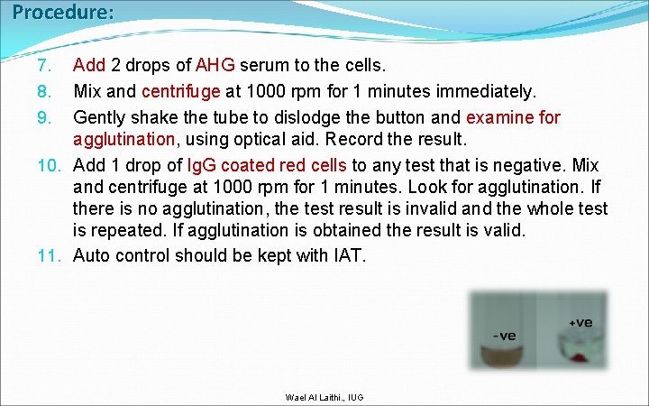Procedure: Add 2 drops of AHG serum to the cells. Mix and centrifuge at