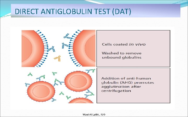 DIRECT ANTIGLOBULIN TEST (DAT) Wael Al Laithi. , IUG 