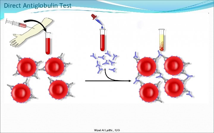 Direct Antiglobulin Test Wael Al Laithi. , IUG 