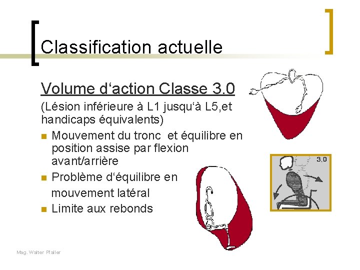 Classification actuelle Volume d‘action Classe 3. 0 (Lésion inférieure à L 1 jusqu‘à L