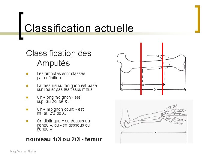 Classification actuelle Classification des Amputés n Les amputés sont classés par definition n La