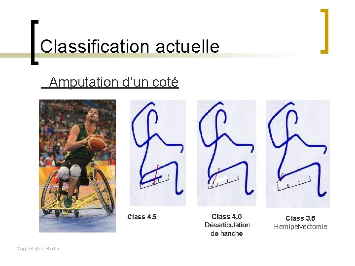 Classification actuelle Amputation d‘un coté Class 4. 5 Mag. Walter Pfaller Class 3. 5