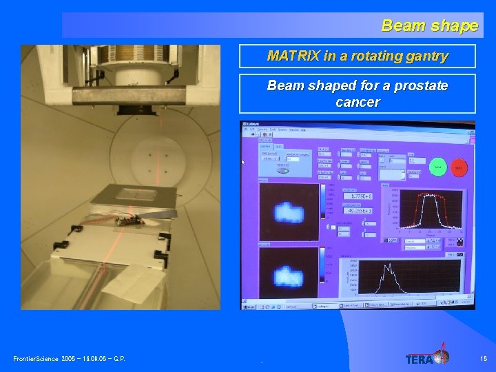 Beam shape MATRIX in a rotating gantry Beam shaped for a prostate cancer Frontier.