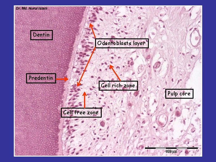 Dentin Odontoblasts layer Predentin Cell rich zone Pulp core Cell free zone 