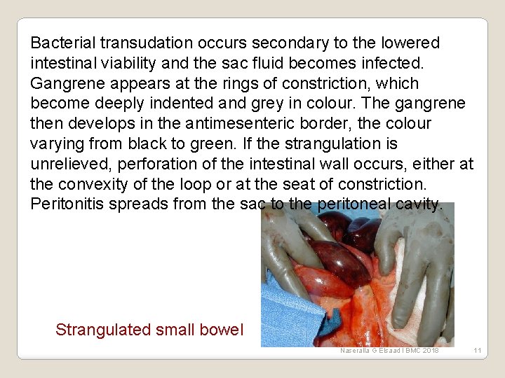 Bacterial transudation occurs secondary to the lowered intestinal viability and the sac fluid becomes