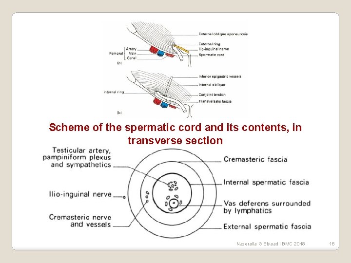 Scheme of the spermatic cord and its contents, in transverse section Naseralla G Elsaad