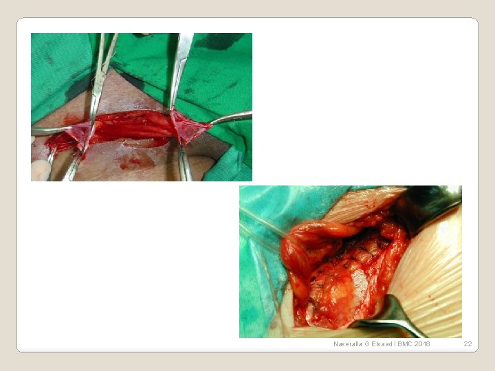 Naseralla G Elsaad l BMC 2018 22 