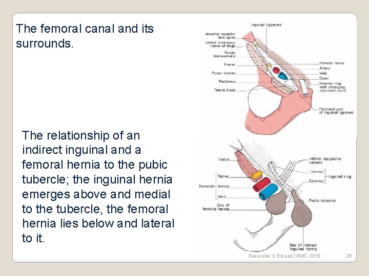 The femoral canal and its surrounds. The relationship of an indirect inguinal and a