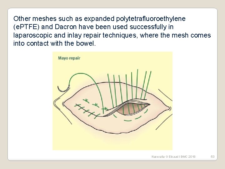 Other meshes such as expanded polytetrafluoroethylene (e. PTFE) and Dacron have been used successfully