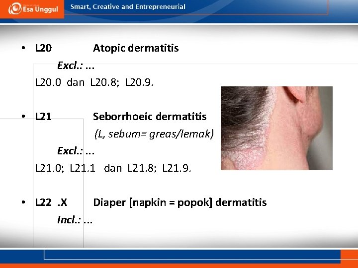  • L 20 Atopic dermatitis Excl. : . . . L 20. 0