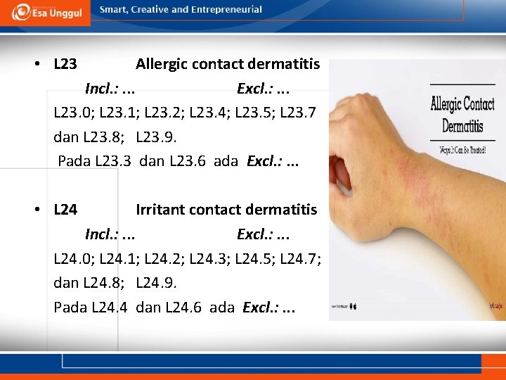  • L 23 Allergic contact dermatitis Incl. : . . . Excl. :