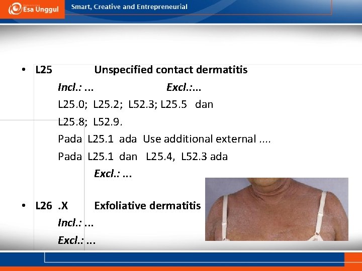  • L 25 Unspecified contact dermatitis Incl. : . . . Excl. :