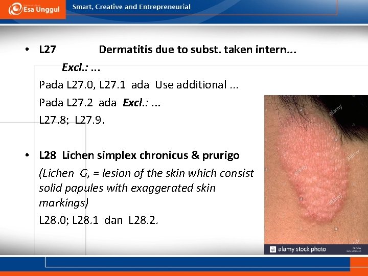  • L 27 Dermatitis due to subst. taken intern. . . Excl. :