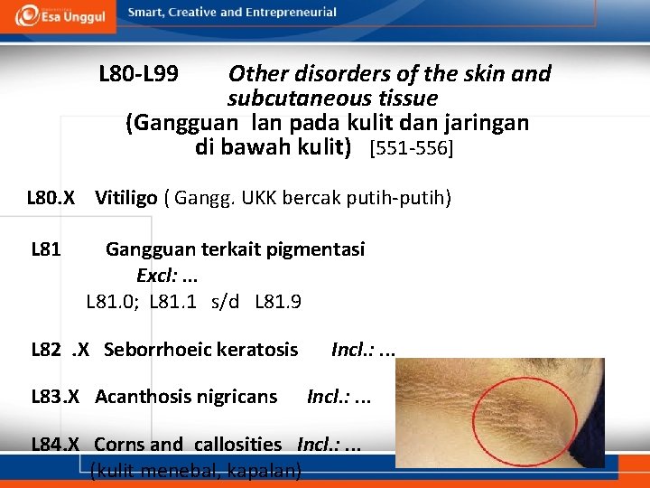 L 80 -L 99 Other disorders of the skin and subcutaneous tissue (Gangguan lan