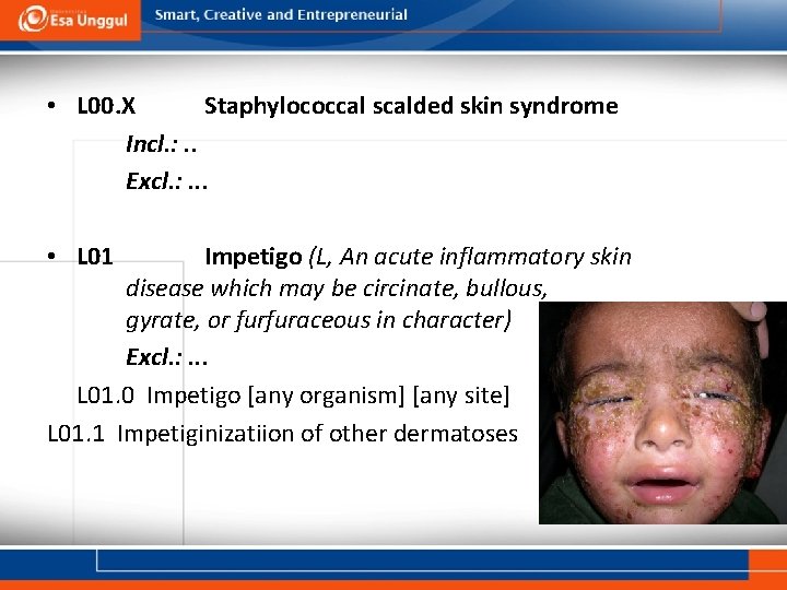 • L 00. X Staphylococcal scalded skin syndrome Incl. : . . Excl.