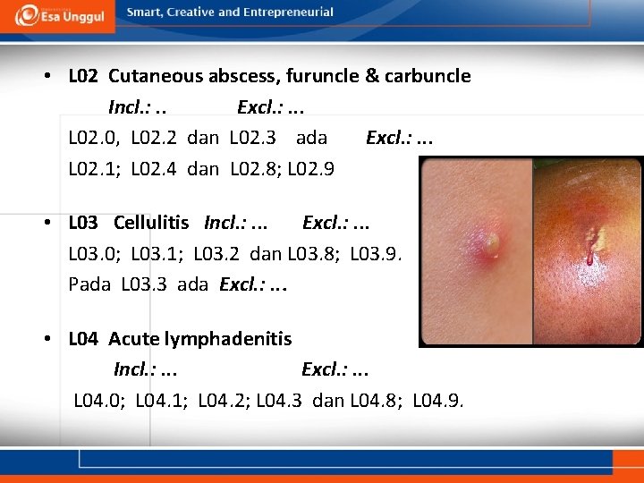  • L 02 Cutaneous abscess, furuncle & carbuncle Incl. : . . Excl.