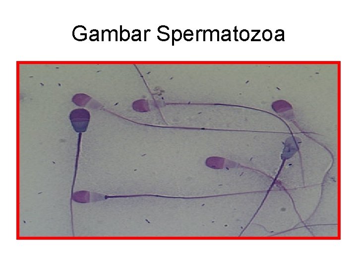 Gambar Spermatozoa 