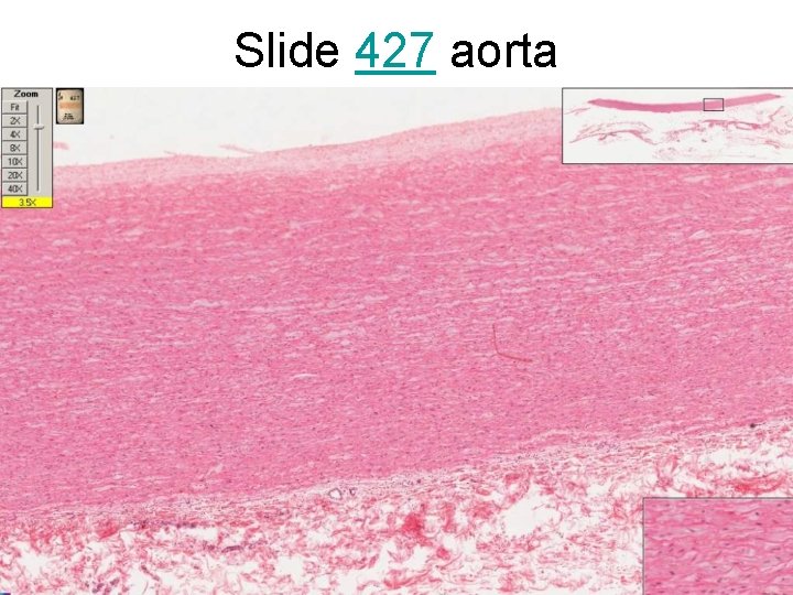 Slide 427 aorta 