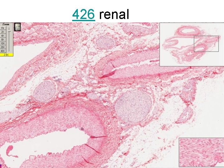 426 renal 