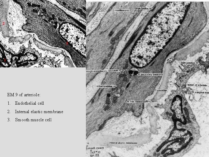 EM 9 of arteriole: 1. Endothelial cell 2. Internal elastic membrane 3. Smooth muscle