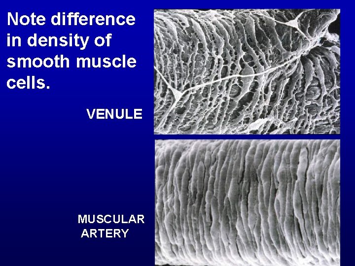 Note difference in density of smooth muscle cells. VENULE MUSCULAR ARTERY 