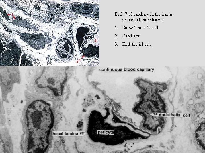 EM 17 of capillary in the lamina propria of the intestine 1. Smooth muscle