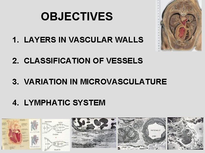 OBJECTIVES 1. LAYERS IN VASCULAR WALLS 2. CLASSIFICATION OF VESSELS 3. VARIATION IN MICROVASCULATURE