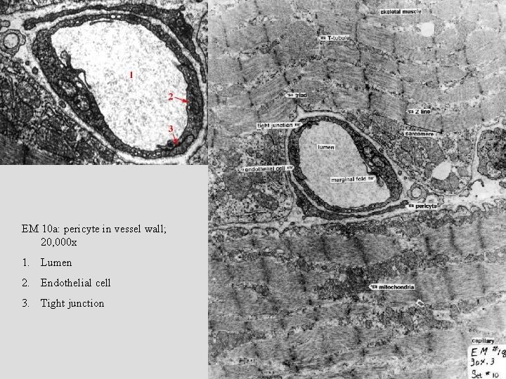 EM 10 a: pericyte in vessel wall; 20, 000 x 1. Lumen 2. Endothelial