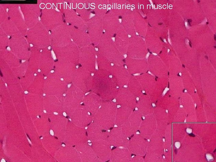 CONTINUOUS capillaries in muscle 