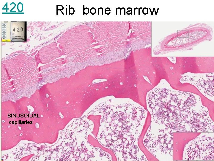 420 SINUSOIDAL capillaries Rib bone marrow 