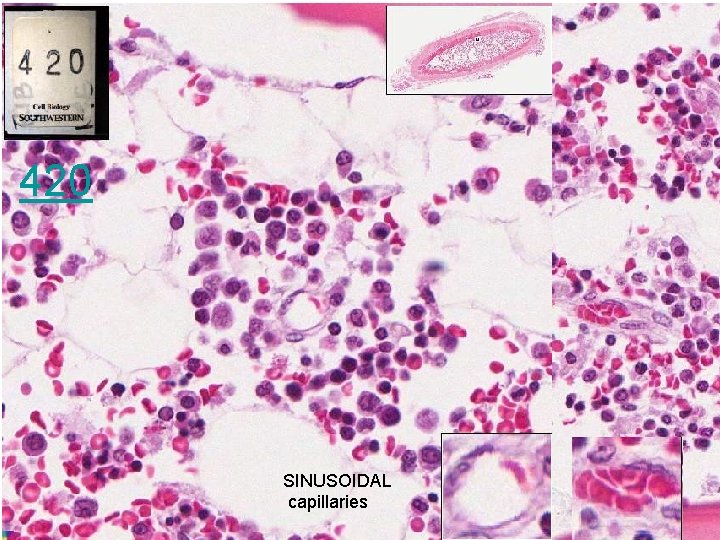 420 SINUSOIDAL capillaries 