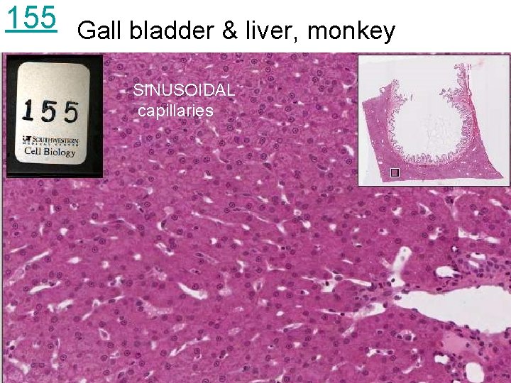 155 Gall bladder & liver, monkey SINUSOIDAL capillaries 