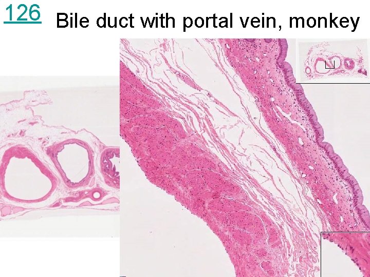 126 Bile duct with portal vein, monkey 