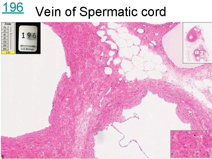 196 Vein of Spermatic cord 