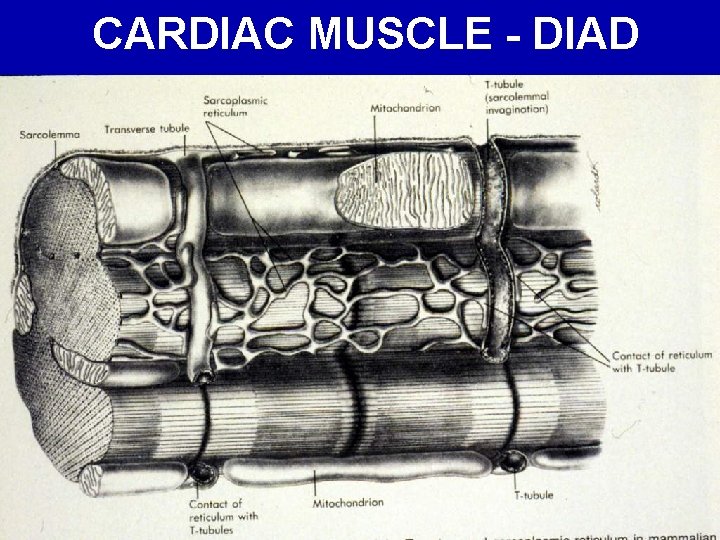 CARDIAC MUSCLE - DIAD 