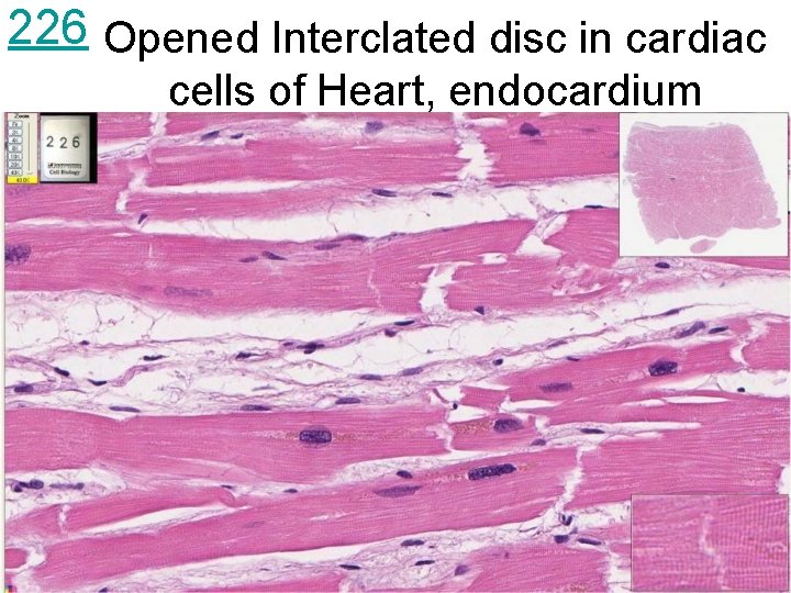 226 Opened Interclated disc in cardiac cells of Heart, endocardium 