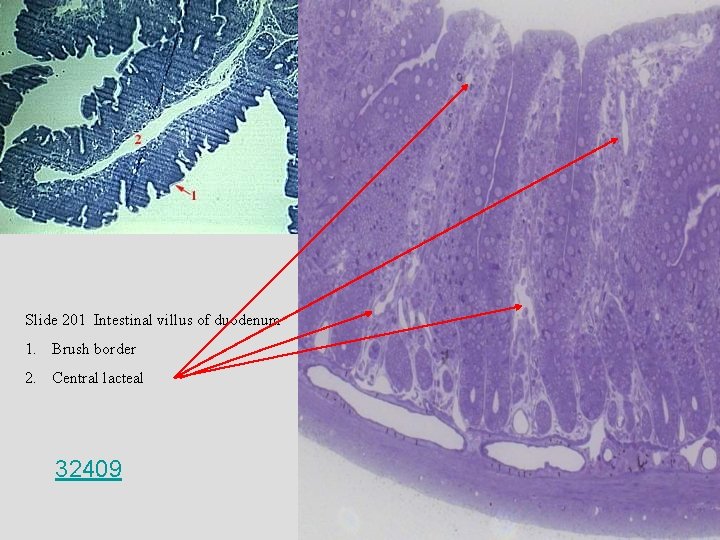 Slide 201 Intestinal villus of duodenum 1. Brush border 2. Central lacteal 32409 