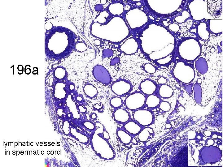 196 a lymphatic vessels in spermatic cord 