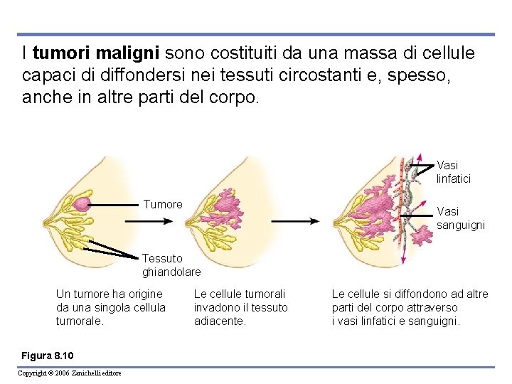 I tumori maligni sono costituiti da una massa di cellule capaci di diffondersi nei