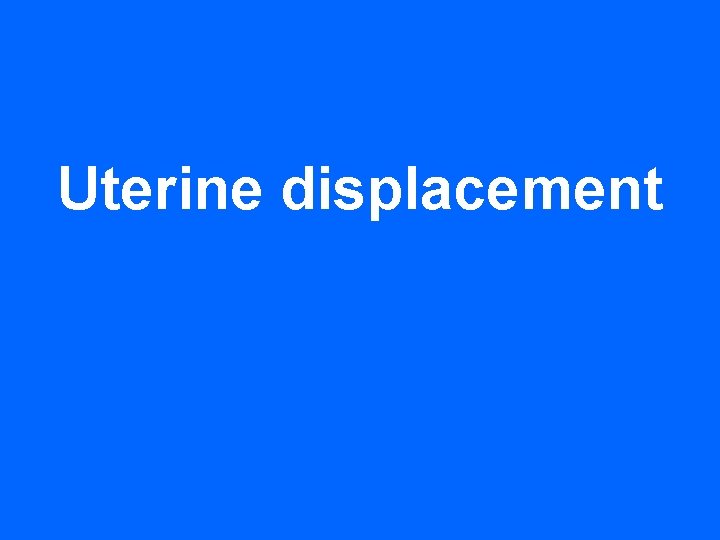 Uterine displacement 