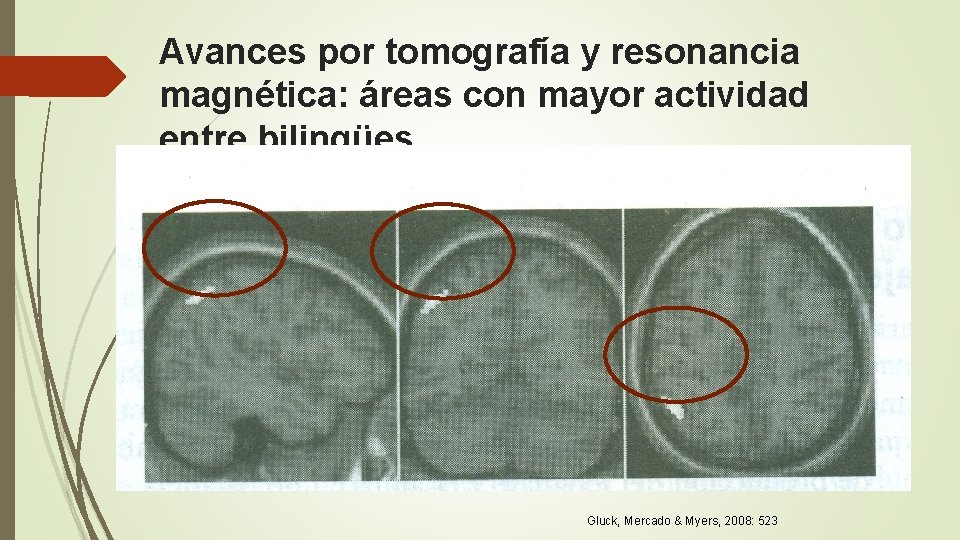 Avances por tomografía y resonancia magnética: áreas con mayor actividad entre bilingües Gluck, Mercado