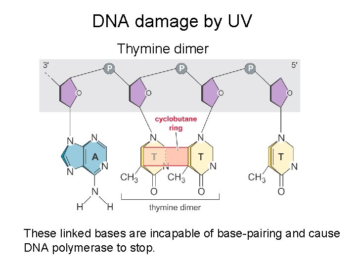 DNA damage by UV Thymine dimer These linked bases are incapable of base-pairing and