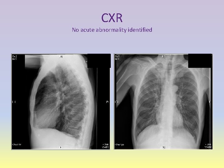 CXR No acute abnormality identified 