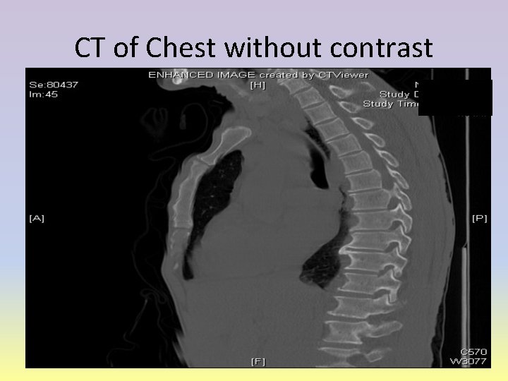 CT of Chest without contrast 