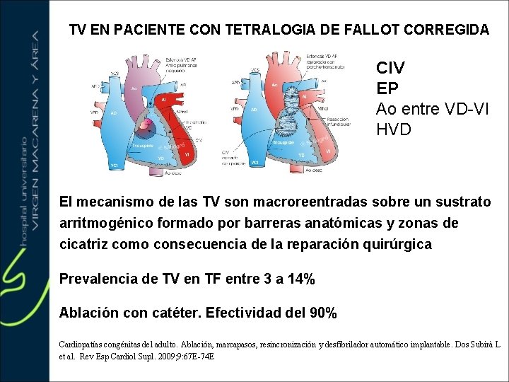 TV EN PACIENTE CON TETRALOGIA DE FALLOT CORREGIDA CIV EP Ao entre VD VI