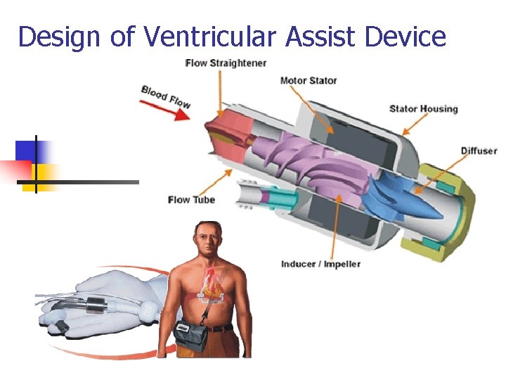 Design of Ventricular Assist Device 